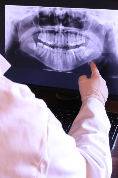 Best Chipped Tooth Repair Near Me  in Slatington, PA